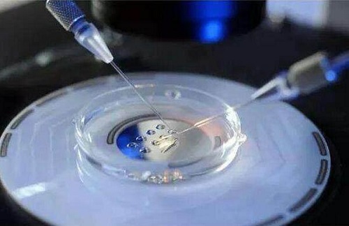 五次试管失败，美国试管婴儿保障单周期成功率