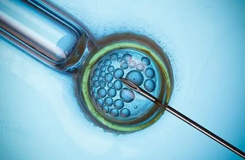 试管婴儿男方需要做的检查有哪些？在什么时间检查最佳？