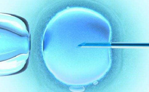 去美国做试管：科学促排卵避免卵巢过度刺激症OHSS