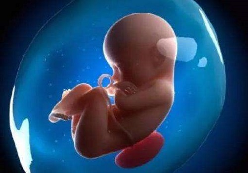 多囊卵巢去美国做试管婴儿适合吗？
