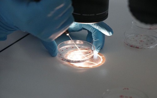 高龄一定要做三代试管吗？怎么成功？