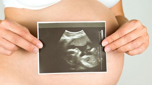 避免泰国试管婴儿宫外孕，可以先结扎吗？
